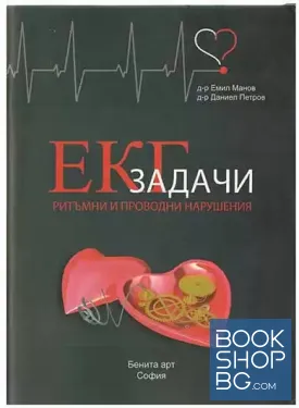 Ритъмни и проводни нарушения: ЕКГ задачи