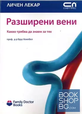 Разширени вени