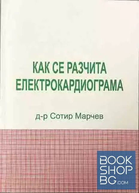 View 1 of Как се разчита електрокардиограма