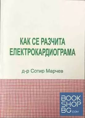 Как се разчита електрокардиограма