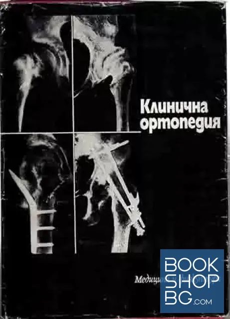 View 1 of Клинична ортопедия
