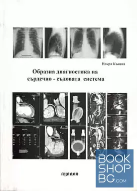 Образна диагностика на сърдечно-съдовата система