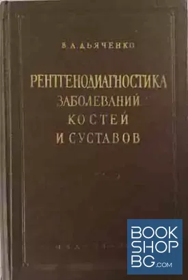 Рентгенодиагностика заболеваний костей и суставов