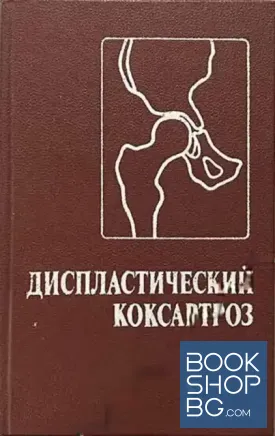 Диспластический коксартроз