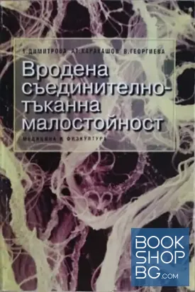 Вродена съединително-тъканна малостойност