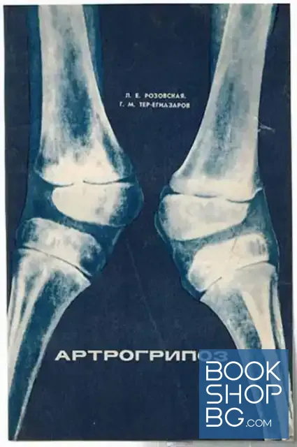 View 1 of Артрогрипоз