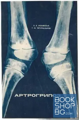 Артрогрипоз