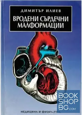 Вродени сърдечни малформации
